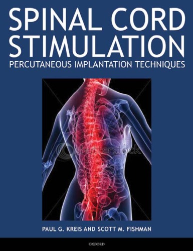 Spinal Cord Stimulation Implantation Percutaneous Implantation Techniques Paul Kreis