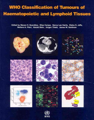 Who Classification Of Tumours Of Hematopoietic And Lymphoid Tissues 4th Edition Fourth Edition The International Agency For Research On Cancer
