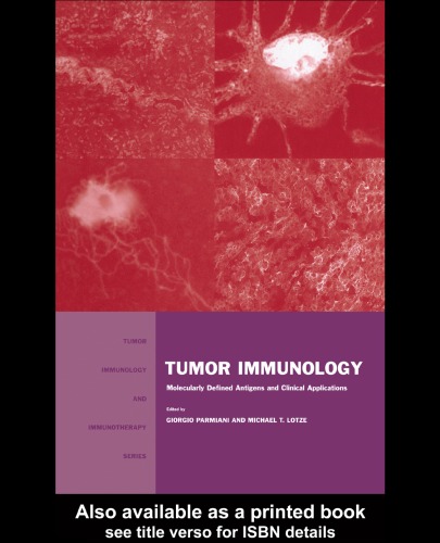 Tumor Immunology Molecularly Defined Antigens And Clinical Applications Tumor Immunology Immunotherapy 1st Edition Giorgio Parmiani