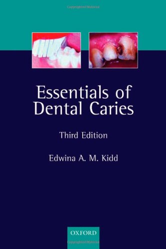 Essentials Of Dental Caries The Disease And Its Management 3rd Edition Edwina A M Kidd
