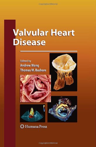 Valvular Heart Disease 1st Edition William Clifford Roberts Md