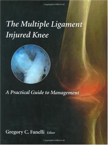 The Multiple Ligament Injured Knee A Practical Guide To Management 1st Edition Gregory C Fanelli
