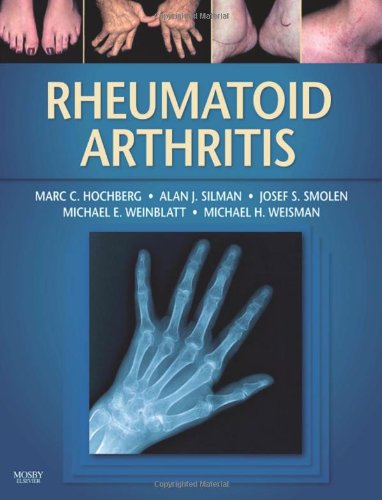 Rheumatoid Arthritis 1st Edition Marc C Hochberg Md Mph Alan J Silman Md