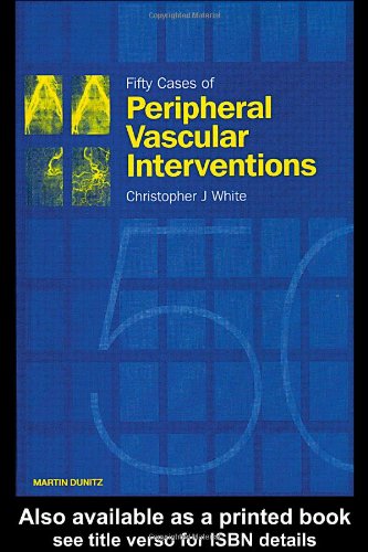 Fifty Cases Of Peripheral Vascular Interventions 1st Edition Christopher J White