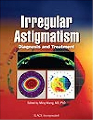 Irregular Astigmatism Diagnosis And Treatment 1st Ming Wang Md