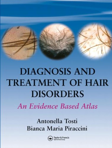 Diagnosis And Treatment Of Hair Disorders An Evidencebased Atlas 1st Edition Antonella Tosti
