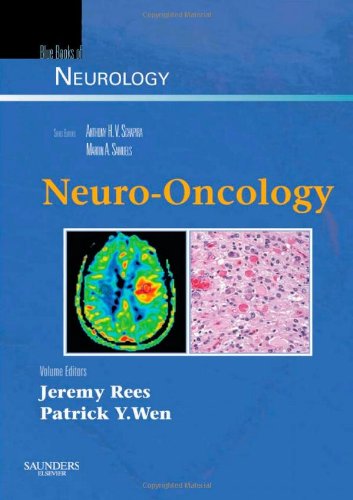 Neurooncology Jeremy Rees And Patrick Y Wen Eds