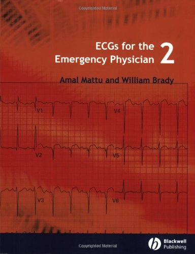 Ecgs For The Emergency Physician 2 1st Edition Amal Mattu William J Brady