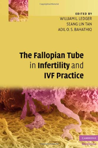 The Fallopian Tube In Infertility And Ivf Practice 1st Edition William L Ledger