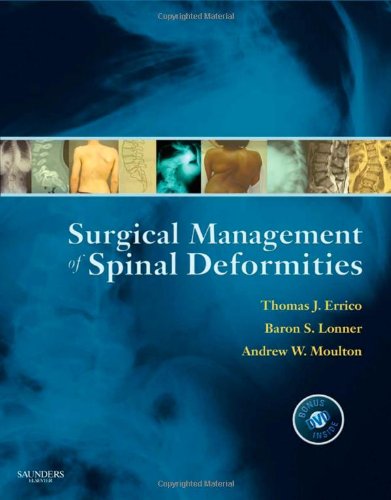 Surgical Management Of Spinal Deformities 1 Harpsc Thomas J Errico Md