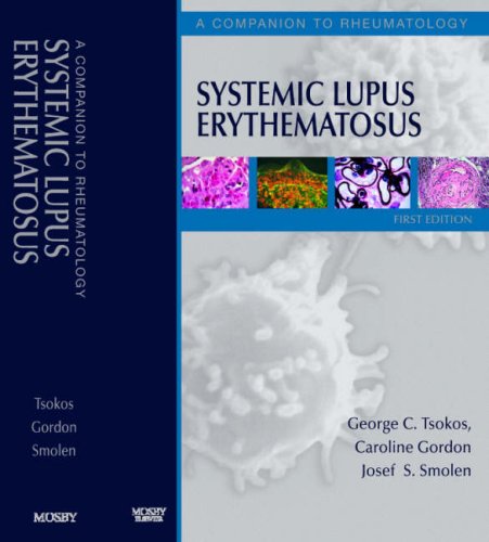 Systemic Lupus Erythematosus A Companion To Rheumatology 1st Edition George C Tsokos