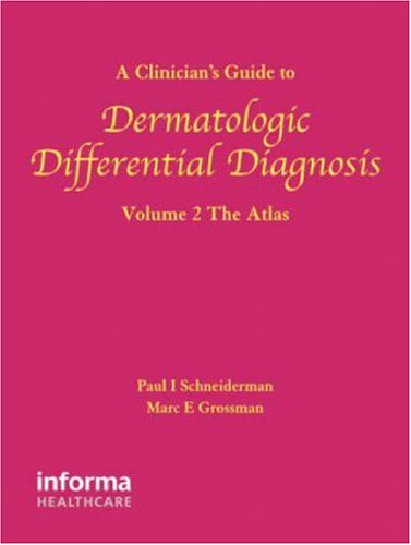 A Clinicians Guide To Dermatologic Differential Diagnosis Volume 2 The Atlas Encyclopedia Of Differential Diagnosis In Dermatology 1st Edition Paul Schneiderman