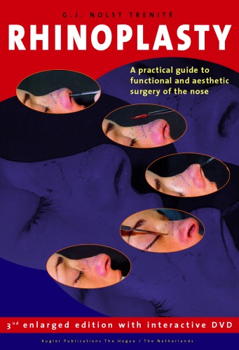 Rhinoplasty A Practical Guide To Functional And Aesthetic Surgery Of The Nose 3rd Edition 3rd Edition Trenite Nolst