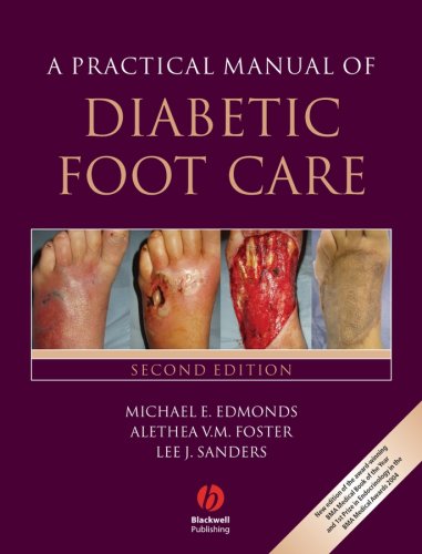 A Practical Manual Of Diabetic Foot Care Second Edition 2nd Edition Michael E Edmonds