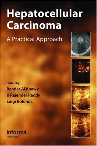 Hepatocellular Carcinoma A Practical Approach 1st Edition Bandar Al Knawy