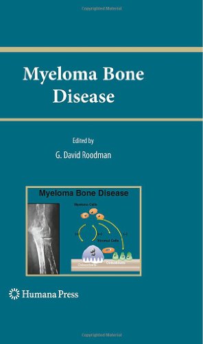 Myeloma Bone Disease 1st Edition Rebecca Silbermann G David Roodman Auth