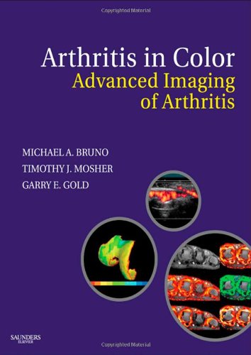 Arthritis In Color Advanced Imaging Of Arthritis 1st Edition Michael A Bruno Md