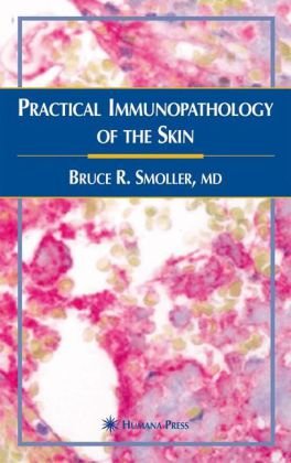 Practical Immunopathology Of The Skin Current Clinical Pathology 1st Edition Bruce R Smoller
