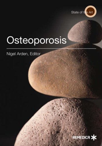 Osteoporosis Illustrated 2nd Edition Nigel Arden