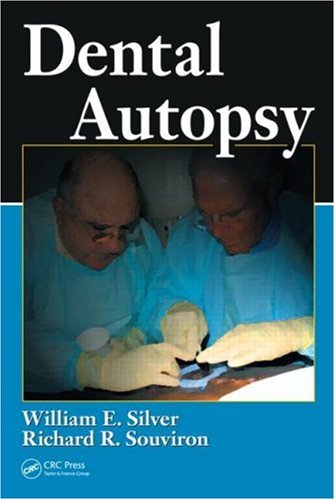 Dental Autopsy 1st Edition William E Silver Richard R Souviron