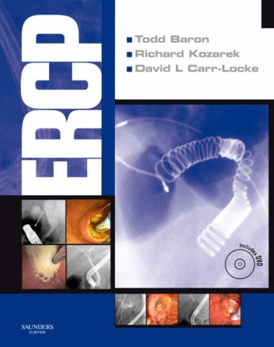 Ercp 1 Hardvdr Todd H Baron Md Richard Kozarek Md David Leslie Carrlocke Md Facg Frcp
