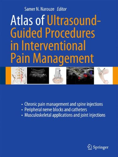 Atlas Of Ultrasoundguided Procedures In Interventional Pain Management 1st Edition Marc A Huntoon Auth