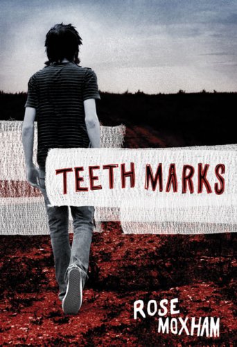 Teeth Marks Moxham