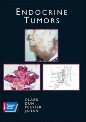 Endocrine Tumors Acs Atlas Of Clinical Oncology 1st Orlo H Clark