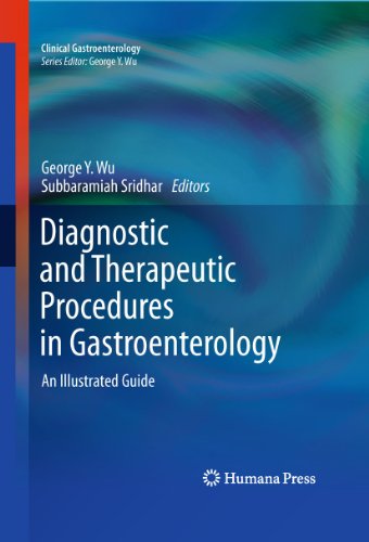 Diagnostic And Therapeutic Procedures In Gastroenterology An Illustrated Guide 1st Edition Nam Q Nguyen Mbbshons