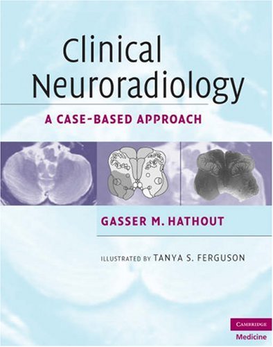 Clinical Neuroradiology A Casebased Approach 1st Edition Gasser M Hathout