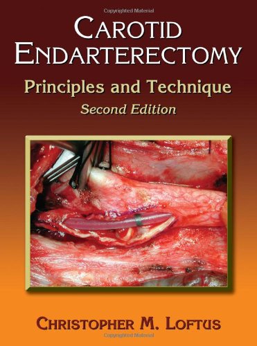 Carotid Endarterectomy Principles And Technique Second Edition 2nd Edition M Loftus Christopher