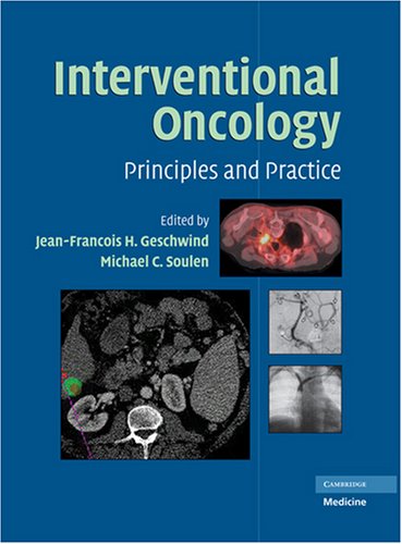 Interventional Oncology Principles And Practice 1st Edition Jeanfranois H Geschwind