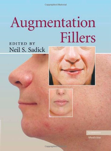 Augmentation Fillers 1st Edition Neil S Sadick Md