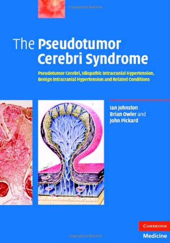 The Pseudotumor Cerebri Syndrome Pseudotumor Cerebri Idiopathic Intracranial Hypertension Benign Intracranial Hypertension And Related Conditions 1st Edition Ian Johnston