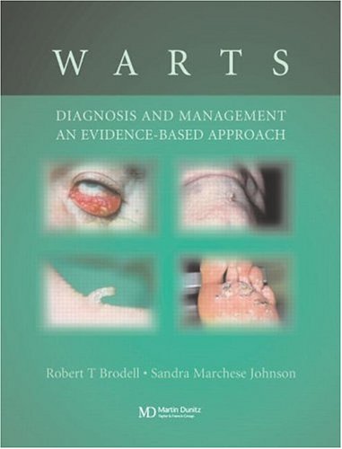 Warts Diagnosis And Management An Evidence Based Approach 1st Edition Robert T Brodell