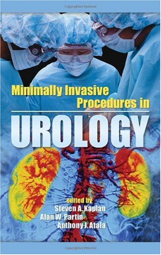 Minimally Invasive Procedures In Urology 1st Edition Steven A Kaplan