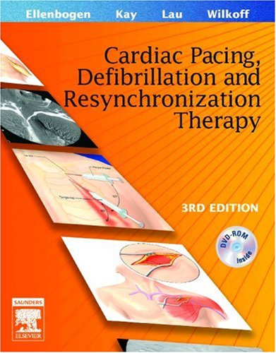 Clinical Cardiac Pacing Defibrillation And Resynchronization Therapy Third Edition 3rd Edition Kenneth A Ellenbogen Md
