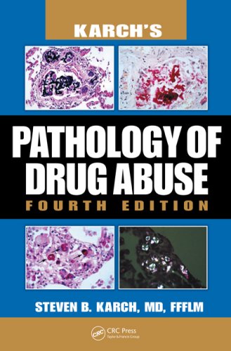 Karchs Pathology Of Drug Abuse Fourth Edition 4th Edition Md