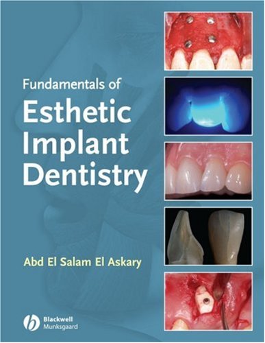 Fundamentals Of Esthetic Implant Dentistry Second Edition 2nd Edition Abd El Salam El Askary