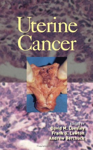 Uterine Cancer 1st Edition David M Luesley Frank Lawton Andrew Berchuck