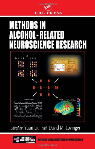 Methods In Alcoholrelated Neuroscience Research Methods And New Frontiers In Neuroscience 1st Edition Yuan Liu