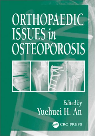Orthopaedic Issues In Osteoporosis 1st Edition Yuehuei H An