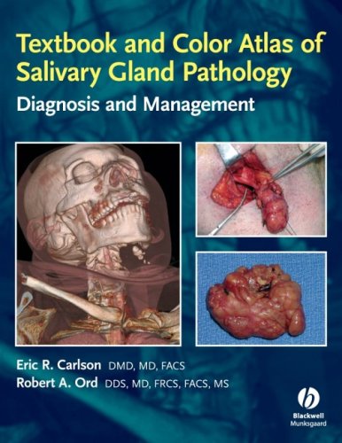 Textbook And Color Atlas Of Salivary Gland Pathology Diagnosis And Management 1st Edition Eric Carlson