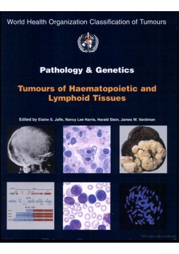 Pathology And Genetics Tumours Of Haematopoietic And Lymphoid Tissues World Health Organization Classification Of Tumours Kindle World Health Organization