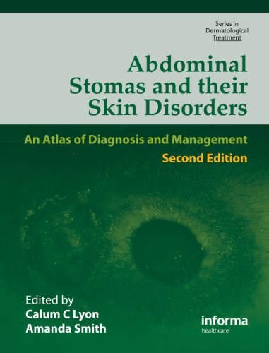 Abdominal Stomas And Their Skin Disorders Second Edition Series In Dermatological Treatment 2nd Edition Calum Lyon