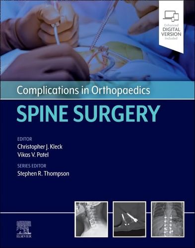 Complications In Orthopaedics Spine Surgery 1st Edition Vikas Patel